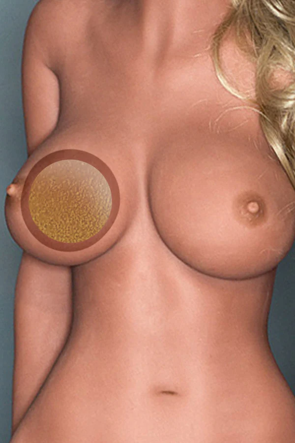 sex doll RCWM Doll Upgrade: Gel-Filled Breasts - R C