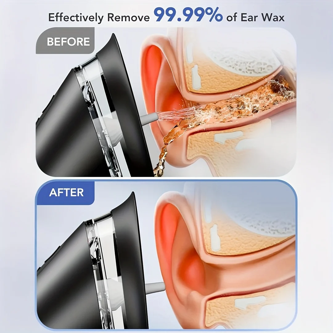 Ear Wax Remover Electric Cleaner USB Rechargeable Water System